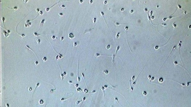 Muestra de espermatozoides, al microscopio
