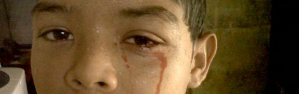 En Córdoba un niño llora lágrimas de sangre